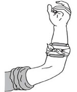 Beispiel Druckverband